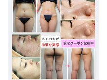 庭夢エステの雰囲気(脂肪燃焼ダイエット~肌質改善まで結果出し!キャンペーン開催中)