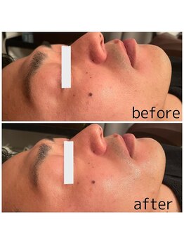 ウイユサロン(oeilsalon)/ヒト幹細胞培養液エキス