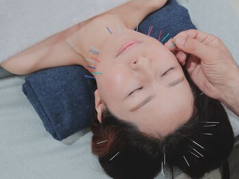 天満みぞぶち整骨院/美容鍼