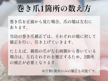 巻き爪料金の仕組み