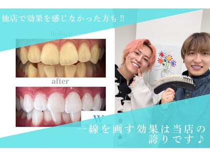 ホワイトニングショップ 池袋店の写真