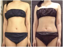 美容整体 ウェリナ 蟹江院/小顔矯正/骨盤矯正/美脚サロン