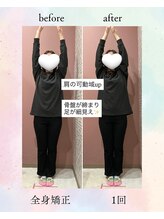 ゆるる(Yururu)/ビフォーアフター(全身矯正)