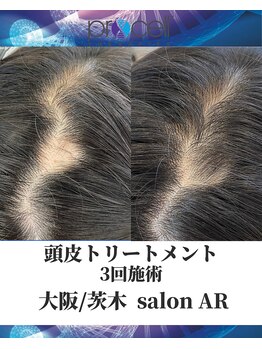 メンズサロンアール(AR)/プロセルセラピーズ