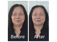 アジアンビューティー(Asian Beauty)の雰囲気（本場韓国仕込の小顔コルギで、安心安全な美小顔が叶います。）