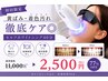【初回限定】黄ばみ・着色汚れ改善◎ホワイトニング40分 ￥11,000→￥2,500