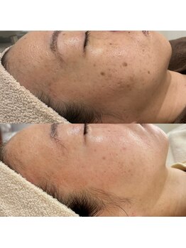 ビューティーワンド ココ(Beauty Wand COCO)/