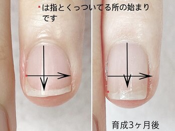 トゥインクリーネイルサロン(Twinkly Nail Salon)/【最強のネイルケア】1回お試し