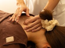 スタジオシュカ鍼灸治療院/施術（肩こり・肩甲骨）