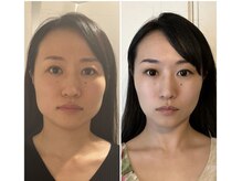 トータルボディケアサロン松濤の雰囲気（小顔・頭皮からリフトアップ！眼精疲労から首肩のコリまで◎）