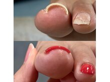 マイカネイルズ(maika nails)の雰囲気（ジェルネイルを楽しみながらできる巻き爪ケアが大人気◎）