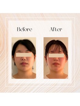 アーマンクラージュ(Ahmen Courage)/頭蓋骨調整/筋膜フェイシャル