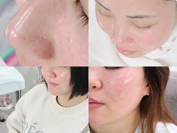 マイ フェア レディ(MY FAIR LADY)の写真/ノーファンデーション。ずっと鏡を見て気になっていた毛穴を綺麗にし素肌に自信がも持てる艶肌へ