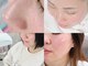 マイ フェア レディ(MY FAIR LADY)の写真/ノーファンデーション。ずっと鏡を見て気になっていた毛穴を綺麗にし素肌に自信がも持てる艶肌へ