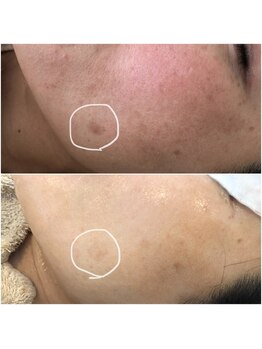 グレーシス(Graces)/色むらのない透明感溢れる肌へ