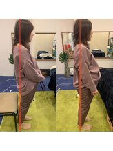 フェムテ(femte)/マタニティ施術前後