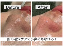 プルーム(Plume)の雰囲気（毛穴ケア１回体験￥5,980 驚きの変化☆皮脂詰まりが取れてツル肌）