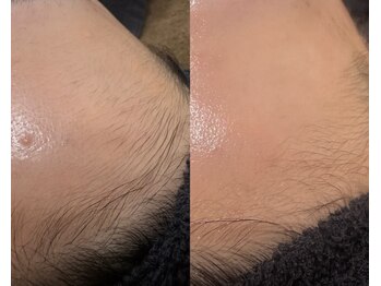 ヴィータ(VITA)/フェイシャルWAX