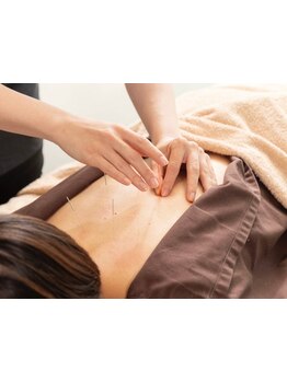 鍼灸施術を受けたい