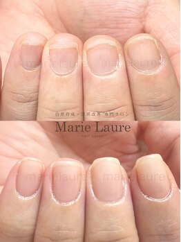 マリーロール 淀屋橋本店(Marie Laure)/自爪育成/深爪矯正/ネイルケア
