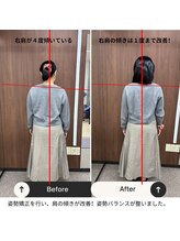 ルピナス整体院/姿勢矯正のビフォーアフター