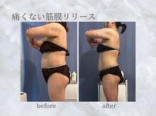 ジュプン 長崎の雰囲気（短期間で効果を実感！目に見てわかる変化を♪）