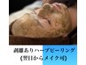 《再来》リピート多数◎ニキビケア・毛穴シミケアに剥離ありハーブピーリング