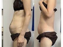 プリマヴェーラ/お腹マッサージで不調一掃します