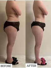 フェミニー(Feminy)/横幅から変わる