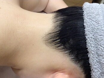 ダリアの写真/【全身脱毛初回限定(シェービング込)】1回￥22000】全身まるごとツル艶肌♪最新機器使用で敏感肌の方にも◎