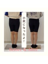 スタイルラボ高松/産後の骨盤矯正の効果♪