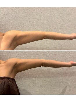 ビュウナ 銀座(BEAUNA)/ブライダル☆セレクトbody