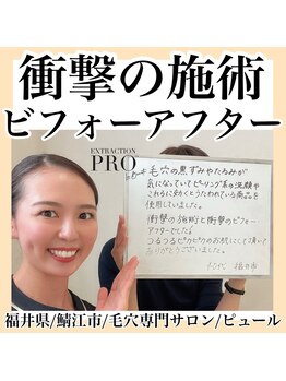 ピュール 鯖江店(PUR)/毛穴/毛穴ケア/毛穴洗浄