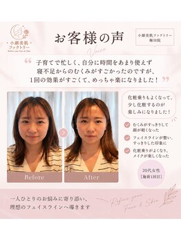 小顔美肌ファクトリー 梅田院/お客様の声