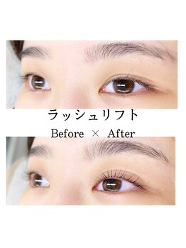 レカロ 熊本本店(RECARO)/ラッシュリフト