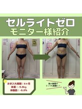 アヤエステティックサロン 綱島店(AYA)/モニター様【ラジオ波】