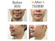 ネクサム(NEXUM)の写真