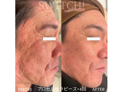 スイッチ(SWITCH!)の写真