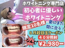 白い歯 浜寺元町店
