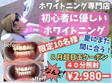 白い歯 浜寺元町店