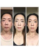 ミチカケ トリムリターン那覇市店/私の変化見てください！