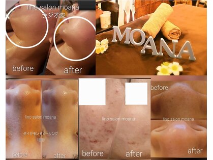 リノサロン モアナ(lino salon moana)の写真
