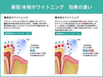 クレア(Crea)/【ホワイトニング効果の違い】
