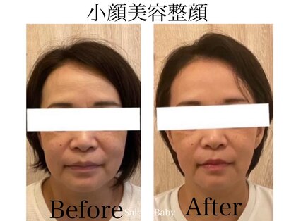 サロンベイビー 西宮本店(Salon Baby)の写真