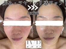 敏感肌でも大丈夫。優しく寄り添う商材で結果の出るケアをご提供