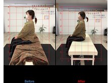 ストレチックス 近江八幡店/肩甲骨周りの痛みを撃退！