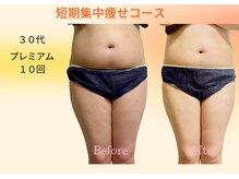 ヨサパーク リボーン(YOSA PARK Reborn)/劇的ビフォーアフター/痩身駒込