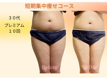 ヨサパーク リボーン(YOSA PARK Reborn)/劇的ビフォーアフター/痩身駒込