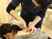 白うさぎ整骨院の雰囲気（硬くなった筋肉を鍼でしっかりゆるめ、動きやすい軽い体へ！）