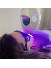 プラチナムビューティ 渋谷店(PLATINUM Beauty)/ホワイトニング